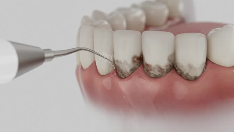 Trusted Wisdom Tooth Removal service in Union, MS - Dentist Open Now